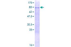 Image no. 1 for Cytokeratin-2P (KRT76) (AA 1-535) protein (GST tag) (ABIN1309034)