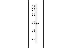 ECAT1 Antibody (N-term) (ABIN655185 and ABIN2844800) western blot analysis in HL-60 cell line lysates (35 μg/lane).