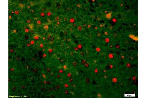 Formalin-fixed and paraffin-embedded rat brain labeled with Anti-HSTF2/HSF2 Polyclonal Antibody, Unconjugated (ABIN686137) 1:200, overnight at 4°C, The secondary antibody was Goat Anti-Rabbit IgG, Cy3 conjugated used at 1:200 dilution for 40 minutes at 37°C.
