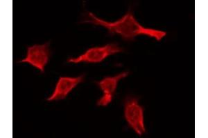 ABIN6274395 staining Hela by IF/ICC. (RBM26 anticorps  (Internal Region))