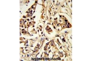 Immunohistochemistry (IHC) image for anti-rho GTPase Activating Protein 18 (ARHGAP18) antibody (ABIN3003783) (ARHGAP18 anticorps)