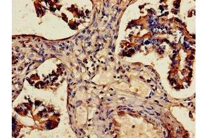 Immunohistochemistry of paraffin-embedded human lung tissue using ABIN7143677 at dilution of 1:100