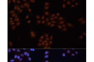 Immunofluorescence analysis of HeLa cells using GTF2I Polyclonal Antibody at dilution of 1:100. (GTF2I anticorps)
