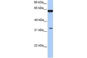 Western Blotting (WB) image for anti-Post-GPI Attachment To Proteins 3 (PGAP3) antibody (ABIN2459368) (PGAP3 anticorps)