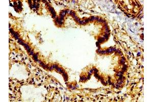 Immunohistochemistry of paraffin-embedded human lung tissue using ABIN7172521 at dilution of 1: 100 (E2F4 anticorps  (AA 160-299))
