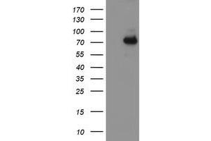 HEK293T cells were transfected with the pCMV6-ENTRY control (Left lane) or pCMV6-ENTRY ALOX15 (Right lane) cDNA for 48 hrs and lysed. (ALOX15 anticorps)