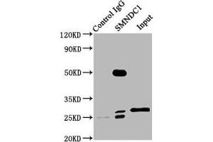 Immunoprecipitating SMNDC1 in Hela whole cell lysate Lane 1: Rabbit control IgG (1 μg) instead of ABIN7171028 in Hela whole cell lysate. (SMNDC1 anticorps  (AA 1-238))