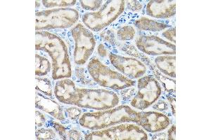 Immunohistochemistry of paraffin-embedded rat testis using NLRP1 Rabbit pAb (ABIN7268935) at dilution of 1:100 (40x lens). (NLRP1 anticorps  (AA 1000-1100))