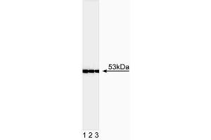 Western blot analysis of p53.