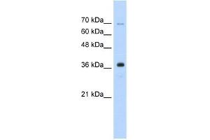 Human HepG2; WB Suggested Anti-ZRANB2 Antibody Titration: 0. (ZNF265 anticorps  (Isoform 2, Middle Region))