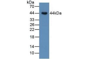 Detection of BMP15 in Human SKOV3 Cells using Polyclonal Antibody to Bone Morphogenetic Protein 15 (BMP15) (BMP15 anticorps  (AA 266-388))