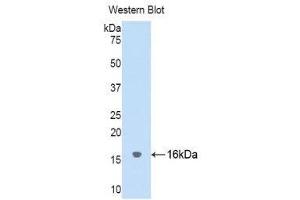 Western Blotting (WB) image for anti-Cystatin SA (CST2) (AA 21-141) antibody (ABIN1176748)
