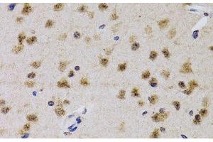 Immunohistochemistry of paraffin-embedded Mouse brain using CDK7 Polyclonal Antibody at dilution of 1:200 (40x lens).