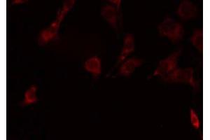 ABIN6278626 staining Hela by IF/ICC.