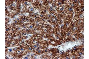 Image no. 11 for anti-NADH Dehydrogenase (Ubiquinone) 1 beta Subcomplex, 9, 22kDa (NDUFB9) (AA 3-179) antibody (ABIN1491359)