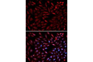 Immunofluorescence analysis of U2OS cell using PSMC2 antibody.