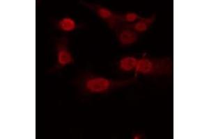 ABIN6266935 staining Hela by IF/ICC. (T-Box 22 anticorps  (N-Term))