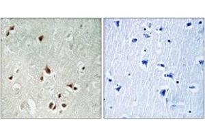 Immunohistochemistry analysis of paraffin-embedded human brain tissue, using HDAC5 (Ab-259) Antibody.