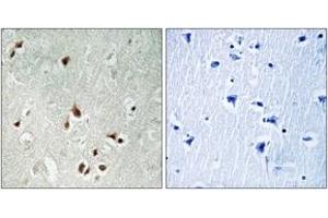 Immunohistochemistry analysis of paraffin-embedded human brain tissue, using HDAC5 (Ab-259) Antibody. (HDAC5 anticorps  (AA 225-274))