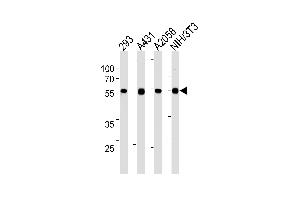 Lane 1: 293 Cell lysates, Lane 2: A431 Cell lysates, Lane 3: A2058 Cell lysates, Lane 4: NIH/3T3 Cell lysates, probed with TPIPb (978CT6. (TPTE2 anticorps)