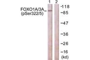Western blot analysis of extracts from NIH-3T3 cells treated with Wortmannin 40nM 24h, using FOXO1A/3A (Phospho-Ser322+Ser325) Antibody. (FOXO1A/3A (AA 291-340), (pSer322) anticorps)
