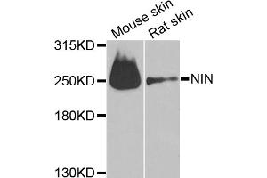 Western blot analysis of extracts of various cell lines, using NIN antibody (ABIN6291434) at 1:1000 dilution. (Ninein anticorps)