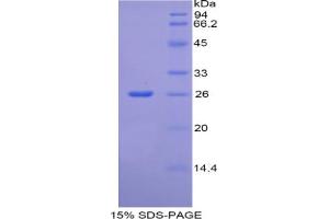 SDS-PAGE analysis of Rat CREB Binding Protein.