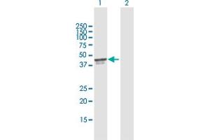 Western Blot analysis of PDCD2 expression in transfected 293T cell line by PDCD2 MaxPab polyclonal antibody. (PDCD2 anticorps  (AA 1-344))