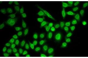 Immunofluorescence analysis of MCF-7 cells using RANGAP1 Polyclonal Antibody (RANGAP1 anticorps)