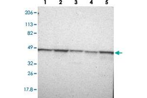 Western blot analysis of lane 1: RT-4, lane 2: U-251 MG, lane 3: A-431, lane 4: Liver and lane 5: Tonsil using FLOT1 polyclonal antibody . (Flotillin 1 anticorps)