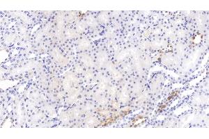 Detection of PCSK9 in Rat Kidney Tissue using Monoclonal Antibody to Proprotein Convertase Subtilisin/Kexin Type 9 (PCSK9)