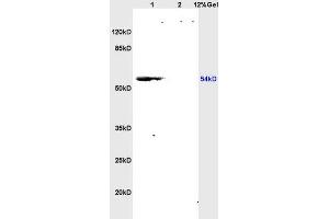 anti-Ribosomal L1 Domain Containing 1 (RSL1D1) (AA 151-250) antibody