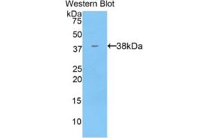 Detection of Recombinant KRT71, Mouse using Polyclonal Antibody to Keratin 71 (KRT71) (Keratin 71 anticorps  (AA 132-440))