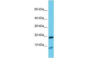 Host: Rabbit Target Name: Grem1 Sample Type: Rat Testis lysates Antibody Dilution: 1.