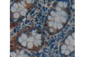 IHC-P analysis of Human Tissue, with DAB staining. (CRADD anticorps  (AA 1-199))
