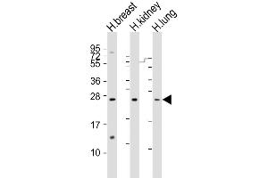 Western Blot at 1:1000-1:2000 dilution Lane 1: human breast lysate Lane 2: human kidney lysate Lane 3: human lung lysate Lysates/proteins at 20 ug per lane. (Adrenomedullin anticorps  (AA 69-96))