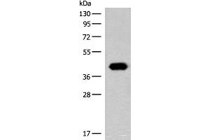 Western blot analysis of Hela cell lysate using GIPC1 Polyclonal Antibody at dilution of 1:400 (GIPC1 anticorps)