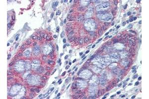 Human Colon: Formalin-Fixed, Paraffin-Embedded (FFPE) (METTL7B anticorps  (C-Term))