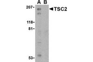 Western blot analysis of TSC2 in L1210 cell lysate with this product at 1 μg/ml in the (A) absence and (B) presence of blocking peptide. (Tuberin anticorps  (C-Term))