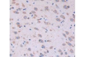 Used in DAB staining on fromalin fixed paraffin- embedded Kidney tissue