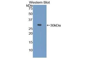 Detection of Recombinant FGA, Mouse using Polyclonal Antibody to Fibrinogen Alpha Chain (FGA)