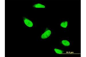 Immunofluorescence of monoclonal antibody to PAPSS1 on HeLa cell.