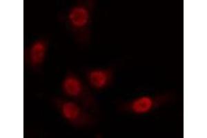 ABIN6274263 staining 293 cells by IF/ICC.