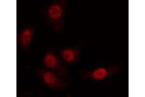 ABIN6274263 staining 293 cells by IF/ICC. (CDK8 anticorps  (N-Term))