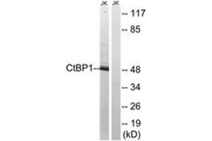 Western blot analysis of extracts from Jurkat cells, using CtBP1 (Ab-422) Antibody. (CTBP1 anticorps  (AA 388-437))