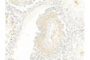 ABIN7094884 and ABIN7098937 at 1/100 staining Rat testis tissue by IHC-P. (TTC7A anticorps  (Internal Region))