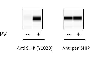 THP1 cells were treated with Pervanadate. (INPP5D Kit ELISA)