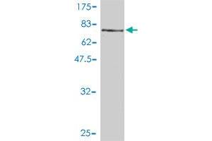 Western Blot detection against Immunogen (73.