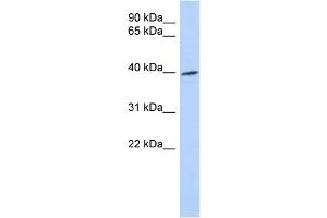 WB Suggested Anti-TRIB1 Antibody Titration: 0. (TRIB1 anticorps  (Middle Region))