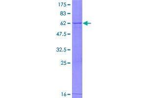 Image no. 1 for Glycerophosphodiester Phosphodiesterase Domain Containing 1 (GDPD1) (AA 1-290) protein (GST tag) (ABIN1354988)
